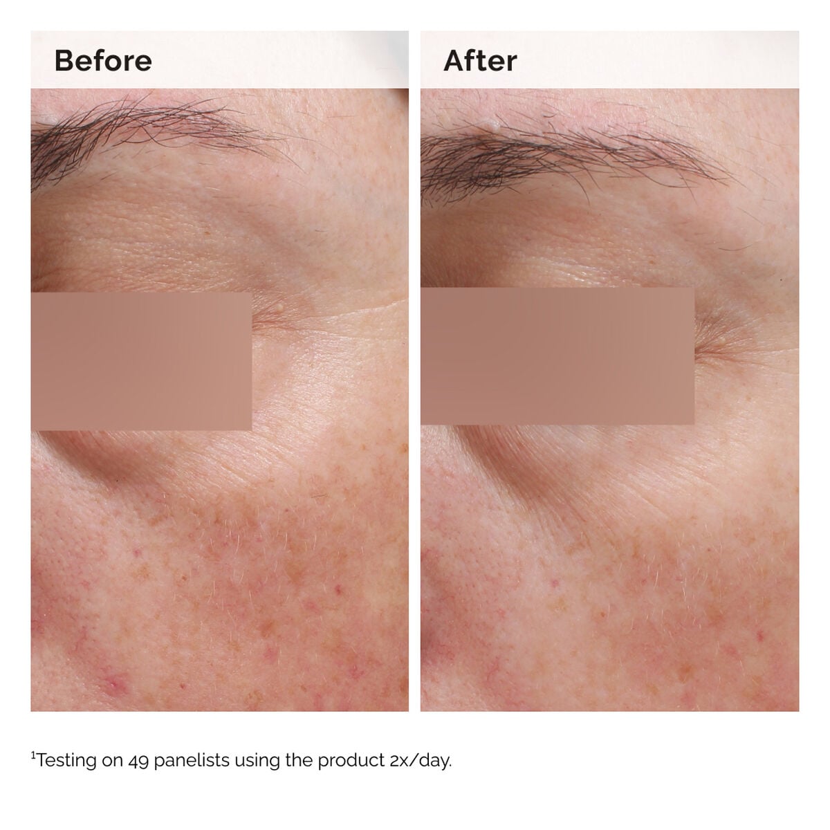 niacinamide-5-face-and-body-emulsion-s2 2024-08-23-ORD-Nia-5pct-Face-Body-B-A-Elasticity-Global-02-1x1.jpg