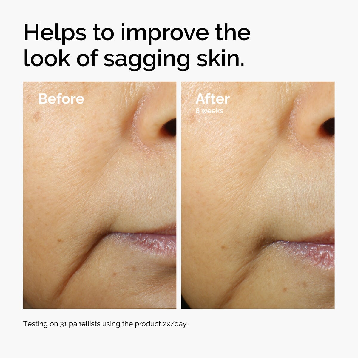 caffeine-3-escin-1-face-serum-c0 ord-caffeine-3pct-escin-1pct-face-serum-before-after-sagging.jpg
