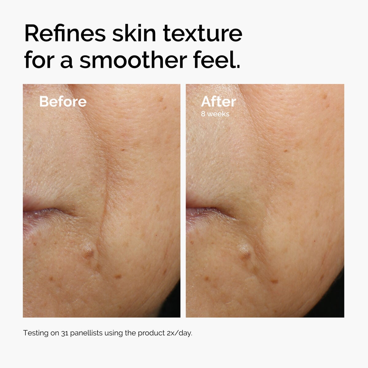 caffeine-3-escin-1-face-serum-c0 ord-caffeine-3pct-escin-1pct-face-serum-before-after-texture.jpg