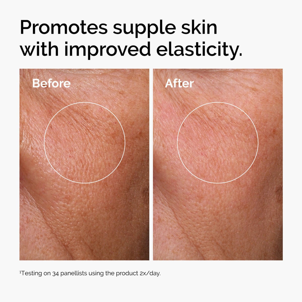 hyaluronic-acid-2-b5-with-ceramides-t4 ord-hyaluronic-acid-2pct-b5-hydrating-serum-before-after-elasticity.jpg