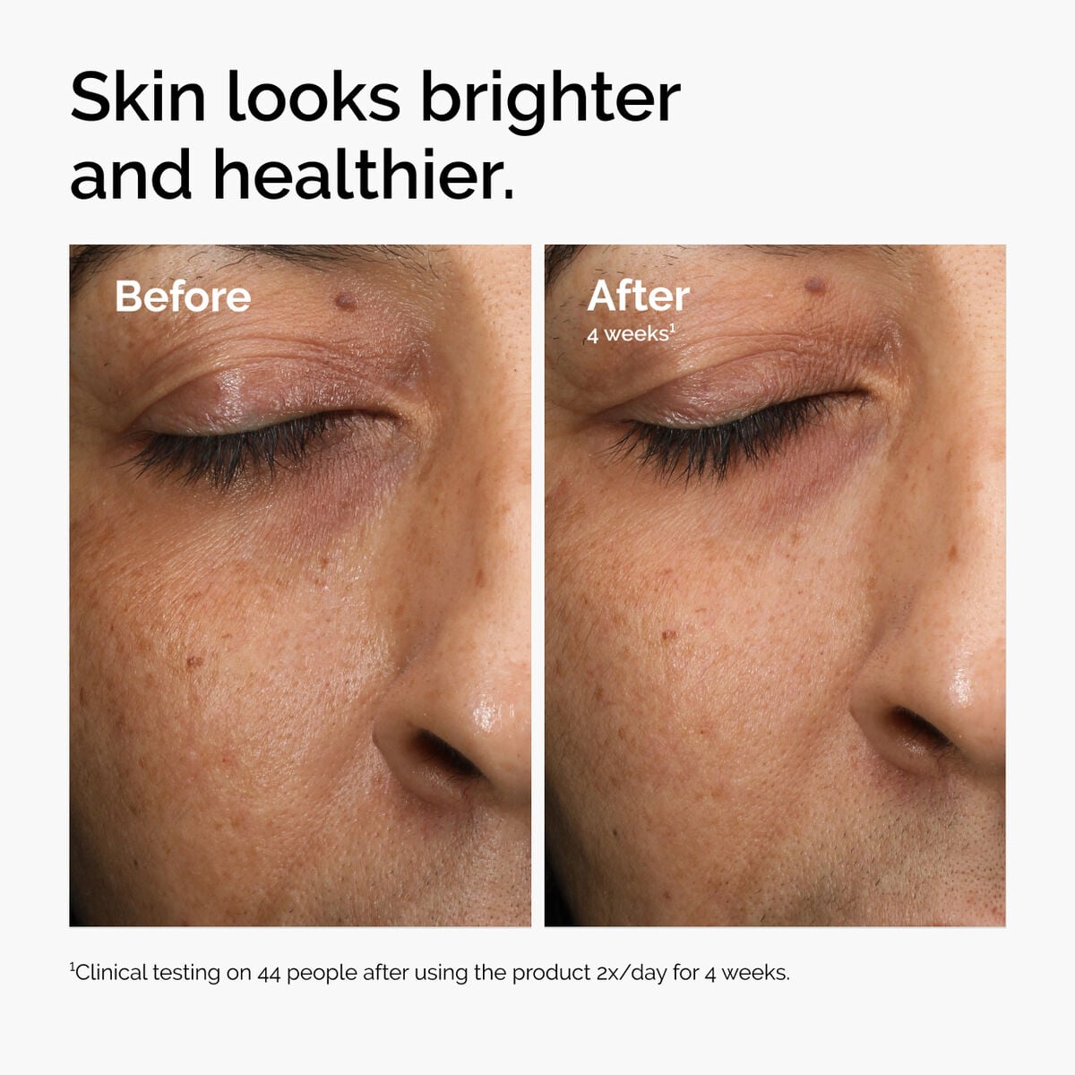 multi-antioxidant-radiance-serum-q7 ord-mars-before-after-healthy.jpg