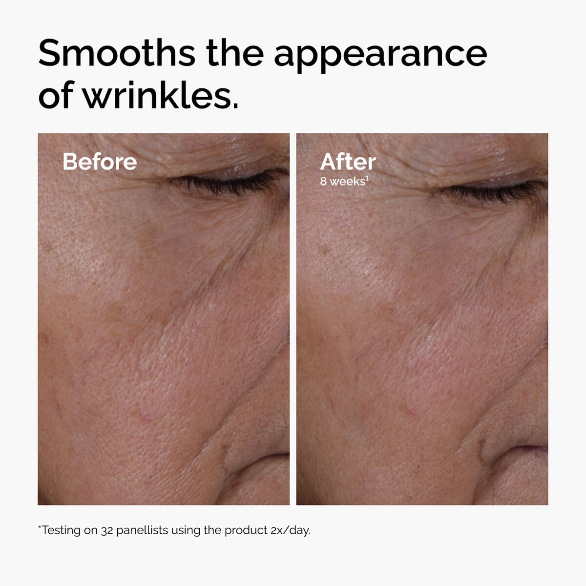 multi-peptide-ha-serum-j2 ord-multi-peptide-ha-serum-wrinkles-before-after.jpg