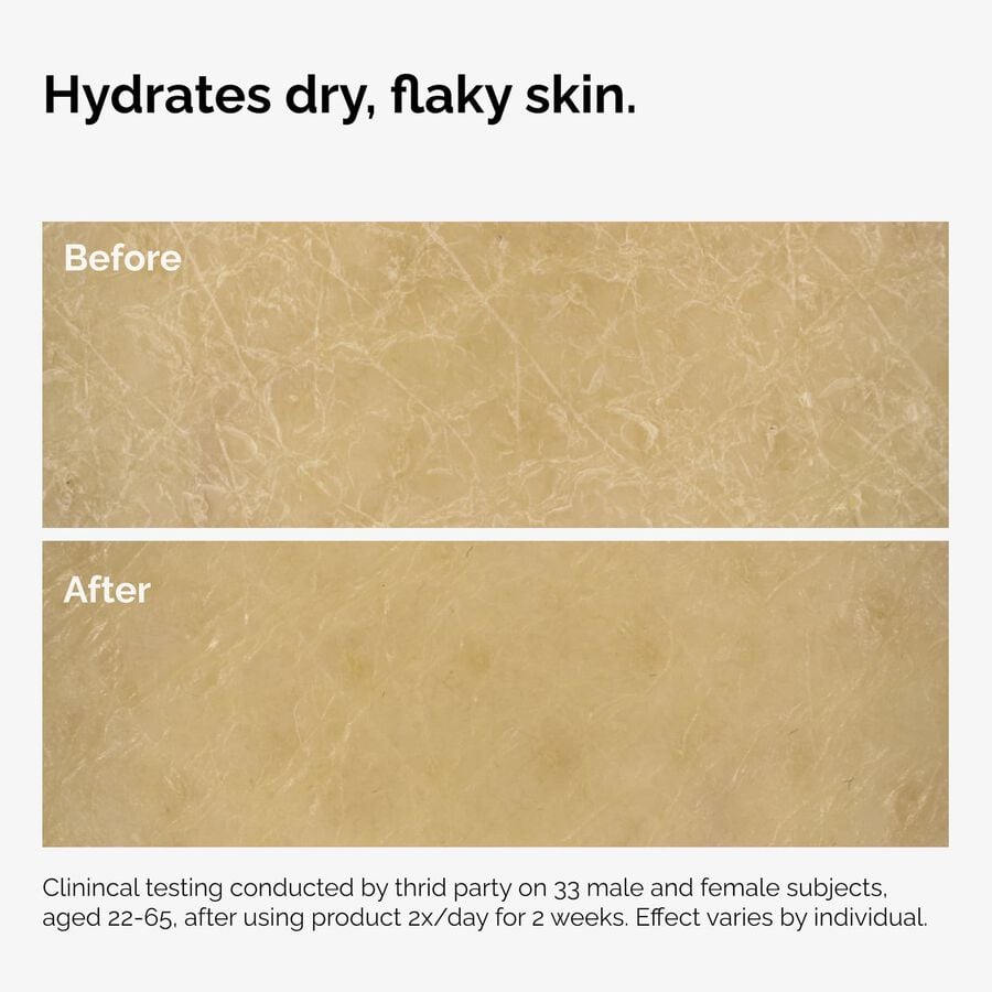 the-body-care-collection-x7 ord-natural-moisturizing-factors-inulin-body-before-after-graphic-02.jpg