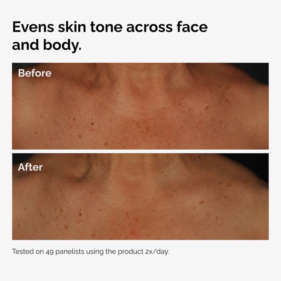 the-body-care-collection-x7 ord-niacinamide-face-body-serum-before-after-even-tone-graphic.jpg