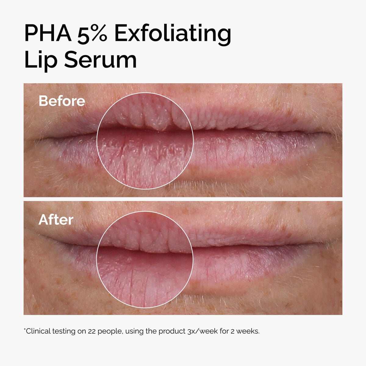 pha-5-exfoliating-lip-serum-j6 ord-pha-5pct-lip-exfoliating-serum-before-after.jpg